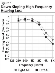 High Frequency Hearing Loss Treatments