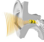 Lyric Hearing Aid reviews